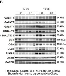 Anti-GALNT2 antibody used in Western Blot (WB). GTX104070