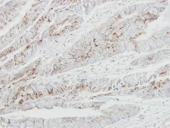 Anti-GALNT2 antibody used in IHC (Paraffin sections) (IHC-P). GTX104070