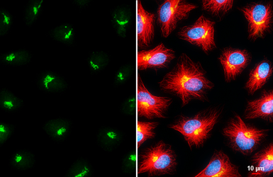 Anti-GALNT2 antibody used in Immunocytochemistry/ Immunofluorescence (ICC/IF). GTX104070
