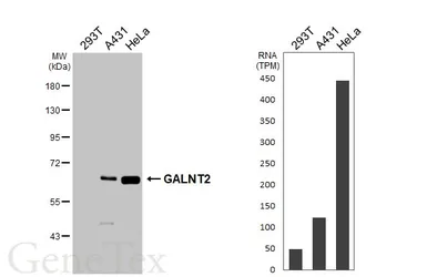 Anti-GALNT2 antibody used in Western Blot (WB). GTX104070