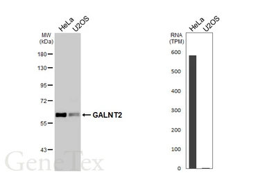 Anti-GALNT2 antibody used in Western Blot (WB). GTX104070