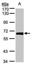 Anti-ZNF169 antibody [N3C3] used in Western Blot (WB). GTX104071