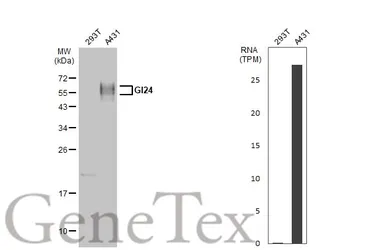 Anti-GI24 antibody used in Western Blot (WB). GTX104081