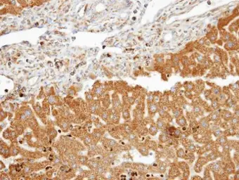 Anti-FDFT1 antibody [N2C3] used in IHC (Paraffin sections) (IHC-P). GTX104091