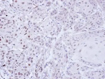 Anti-ZNF165 antibody [N2C3] used in IHC (Paraffin sections) (IHC-P). GTX104092