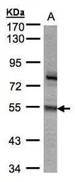 Anti-ZNF165 antibody [N2C3] used in Western Blot (WB). GTX104092