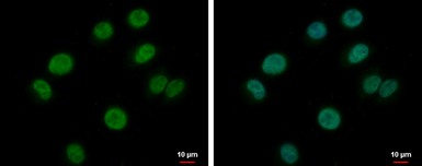 Anti-BRAF35 antibody used in Immunocytochemistry/ Immunofluorescence (ICC/IF). GTX104102