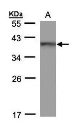 Anti-BRAF35 antibody used in Western Blot (WB). GTX104102