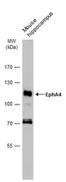 Anti-EphA4 antibody [N3C2], Internal used in Western Blot (WB). GTX104109