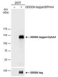 Anti-EphA4 antibody [N3C2], Internal used in Western Blot (WB). GTX104109
