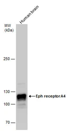 Anti-EphA4 antibody [N3C2], Internal used in Western Blot (WB). GTX104109