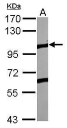Anti-EphA4 antibody [N3C2], Internal used in Western Blot (WB). GTX104109