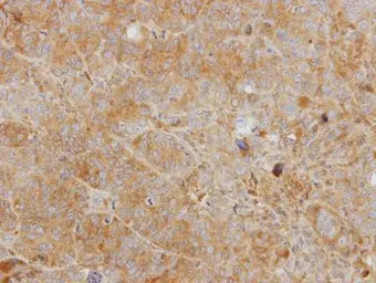 Anti-YKL-39 antibody [N1C3] used in IHC (Paraffin sections) (IHC-P). GTX104110