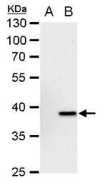 Anti-YKL-39 antibody [N1C3] used in Western Blot (WB). GTX104110