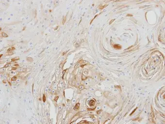 Anti-BCAT2 antibody used in IHC (Paraffin sections) (IHC-P). GTX104121