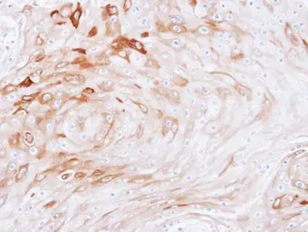 Anti-BCAT2 antibody used in IHC (Paraffin sections) (IHC-P). GTX104121