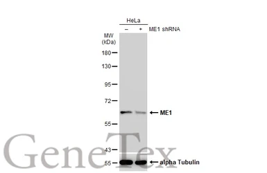 Anti-ME1 antibody used in Western Blot (WB). GTX104122
