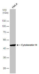 Anti-Cytokeratin 14 antibody used in Western Blot (WB). GTX104124