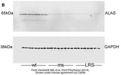 Anti-ALAS-E antibody [N3C3] used in Western Blot (WB). GTX104139