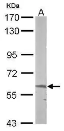 Anti-ALAS-E antibody [N3C3] used in Western Blot (WB). GTX104139