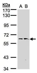 Anti-FMO1 antibody [N1C2] used in Western Blot (WB). GTX104172