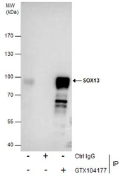 Anti-SOX13 antibody [N1C3] used in Immunoprecipitation (IP). GTX104177