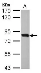 Anti-SOX13 antibody [N1C3] used in Western Blot (WB). GTX104177