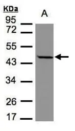 Anti-STOML1 antibody [N2C3] used in Western Blot (WB). GTX104187