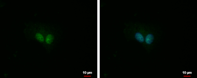 Anti-IP3KC antibody [N3C2], Internal used in Immunocytochemistry/ Immunofluorescence (ICC/IF). GTX104192