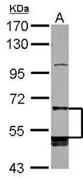 Anti-LILRB5 antibody [N2C1], Internal used in Western Blot (WB). GTX104193