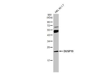 Anti-DUSP19 antibody used in Western Blot (WB). GTX104197