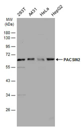Anti-PACSIN2 antibody [N2C3] used in Western Blot (WB). GTX104204