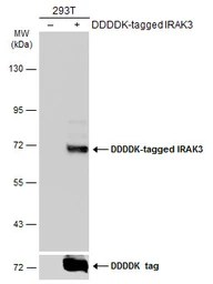 Anti-IRAK3 antibody [N1C1] used in Western Blot (WB). GTX104227