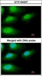 Anti-IRAK3 antibody [N1C1] used in Immunocytochemistry/ Immunofluorescence (ICC/IF). GTX104227