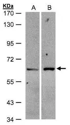 Anti-ZSCAN5 antibody [N2C3] used in Western Blot (WB). GTX104236