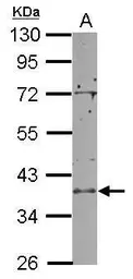 Anti-RCL1 antibody [N1C3] used in Western Blot (WB). GTX104252