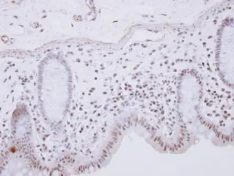 Anti-RCL1 antibody [N1C3] used in IHC (Paraffin sections) (IHC-P). GTX104252