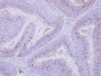 Anti-INPP5F antibody used in IHC (Paraffin sections) (IHC-P). GTX104273