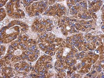 Anti-C4 binding protein B antibody used in IHC (Paraffin sections) (IHC-P). GTX104277