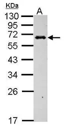 Anti-C4 binding protein B antibody used in Western Blot (WB). GTX104277