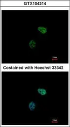 Anti-PSMC6 antibody used in Immunocytochemistry/ Immunofluorescence (ICC/IF). GTX104314