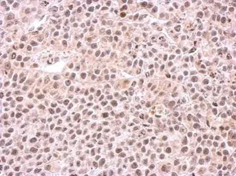 Anti-PSMC6 antibody used in IHC (Paraffin sections) (IHC-P). GTX104314