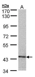 Anti-PSMC6 antibody used in Western Blot (WB). GTX104314