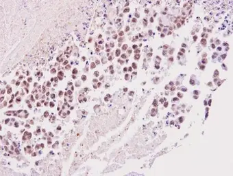 Anti-Timeless antibody [N1N2], N-term used in IHC (Paraffin sections) (IHC-P). GTX104334