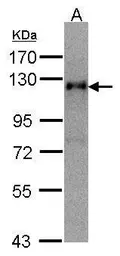 Anti-Timeless antibody [N1N2], N-term used in Western Blot (WB). GTX104334