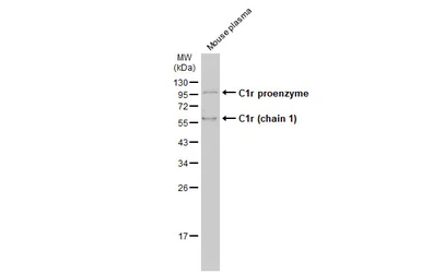 Anti-C1r antibody used in Western Blot (WB). GTX104350