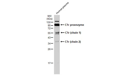 Anti-C1r antibody used in Western Blot (WB). GTX104350