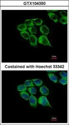 Anti-C1r antibody used in Immunocytochemistry/ Immunofluorescence (ICC/IF). GTX104350