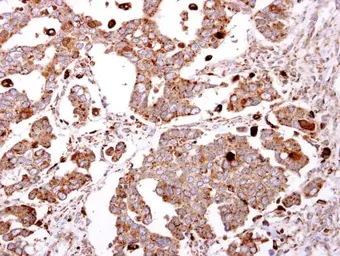 Anti-beta-Gal antibody [N2C3] used in IHC (Paraffin sections) (IHC-P). GTX104360