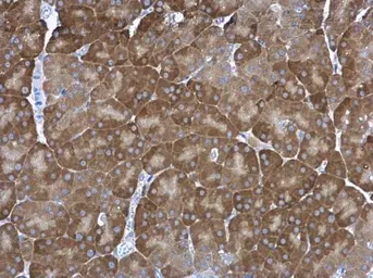 Anti-Proteasome 20S alpha 1 antibody [N1C3] used in IHC (Paraffin sections) (IHC-P). GTX104373